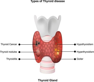 Thyroid outlet